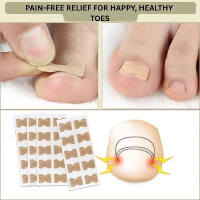 Adhesive Nail Support Strips Low-Profile Gentle Adhesive & Easy Apply