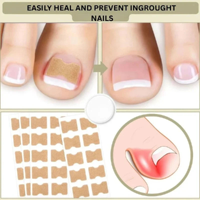 Adhesive Nail Support Strips Low-Profile Gentle Adhesive & Easy Apply