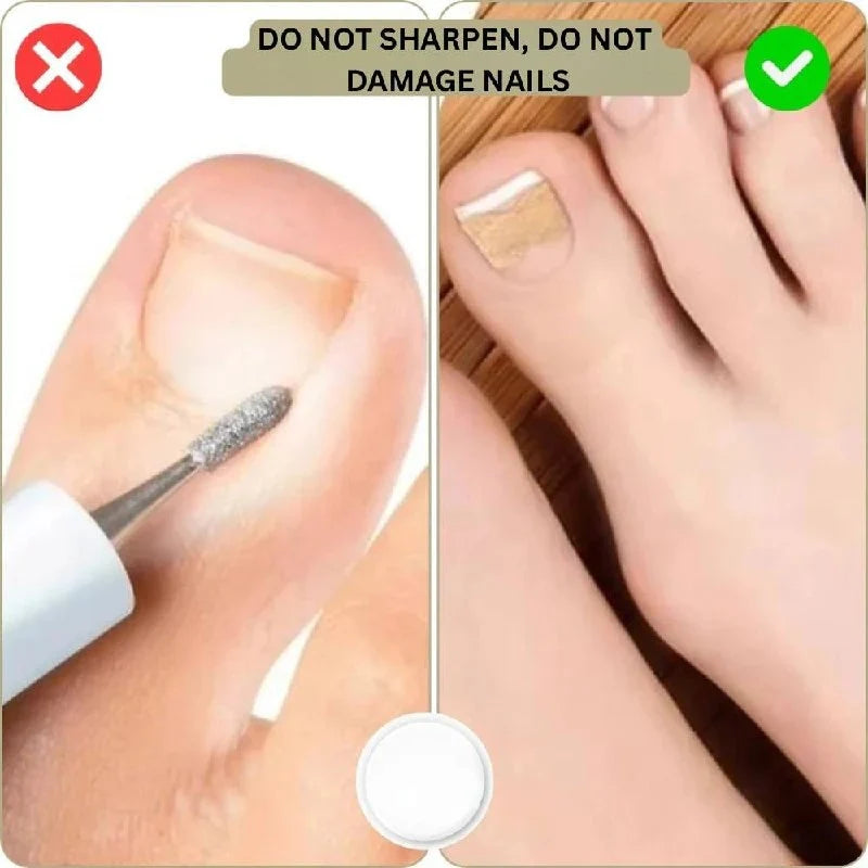 Adhesive Nail Support Strips Low-Profile Gentle Adhesive & Easy Apply