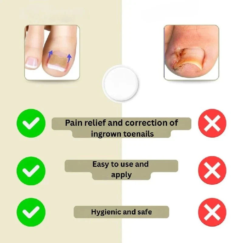 Adhesive Nail Support Strips Low-Profile Gentle Adhesive & Easy Apply