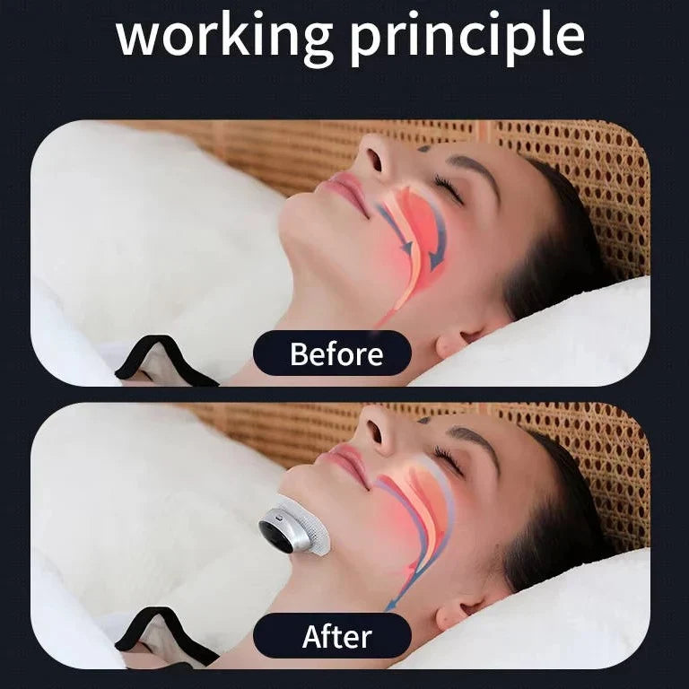 Anti-Snoring Chin Device Automatic Dual Stimulation 10-Hour Battery