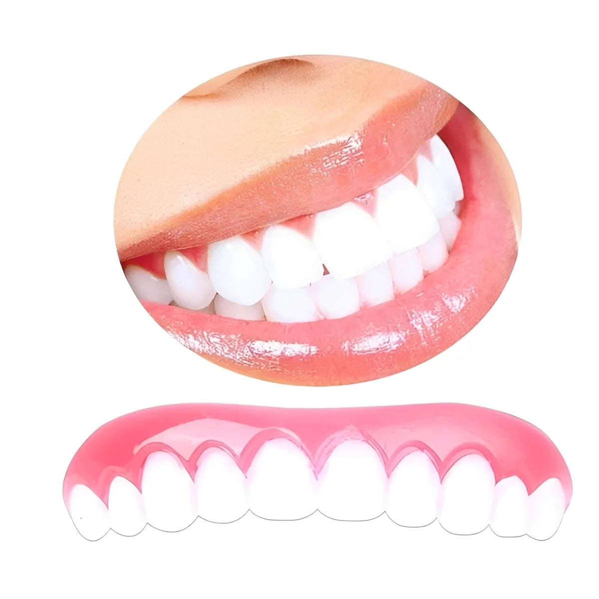 Temporary Tooth Veneer Hot-Water Moldable Reusable & Adhesive-Free