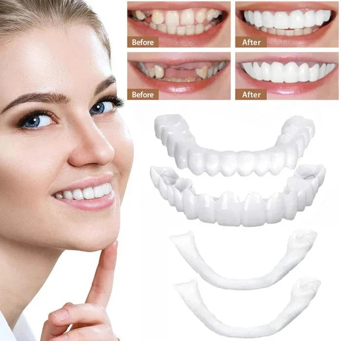 Temporary Veneers Clip-On Reusable Universal Fit