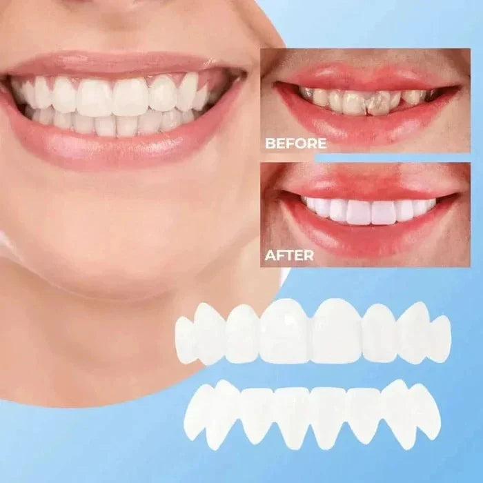 Temporary Veneers Clip-On Reusable Universal Fit