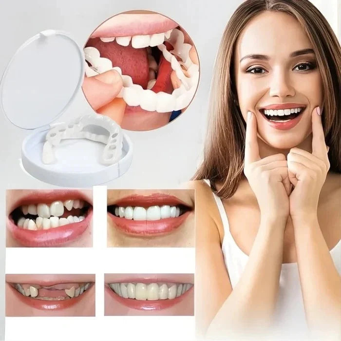 Temporary Veneers Clip-On Reusable Universal Fit