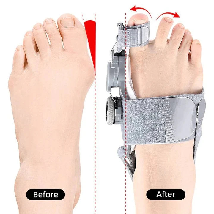 Toe Spacer Adjustable 3D Knob & Silicone Heel Strap